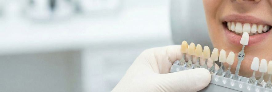 Odontolog&iacute;a Est&eacute;tica